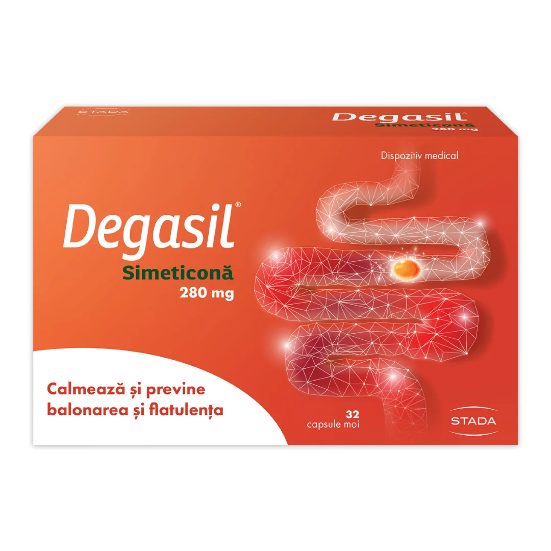 Degasil 280 Mg, 32 Capsule Moi